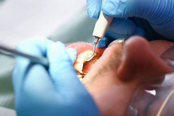 Best Pediatric Emergency Dentist in Kilmarnock, VA